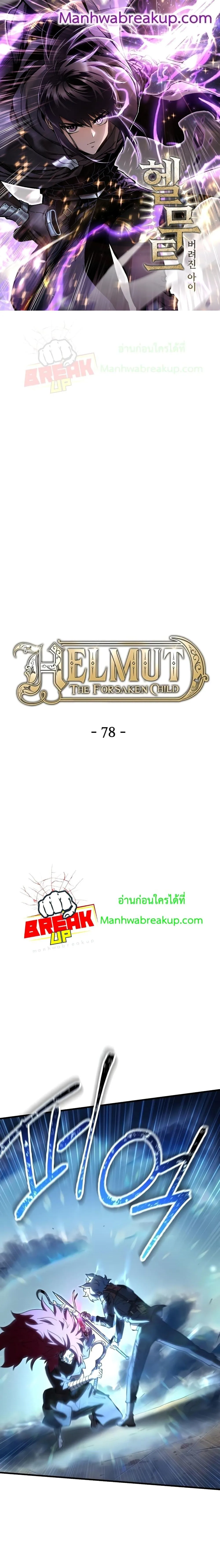 Helmut: The Forsaken Child เฮลมุต: เด็กที่ถูกทอดทิ้ง ตอนที่ 78 หน้า 1